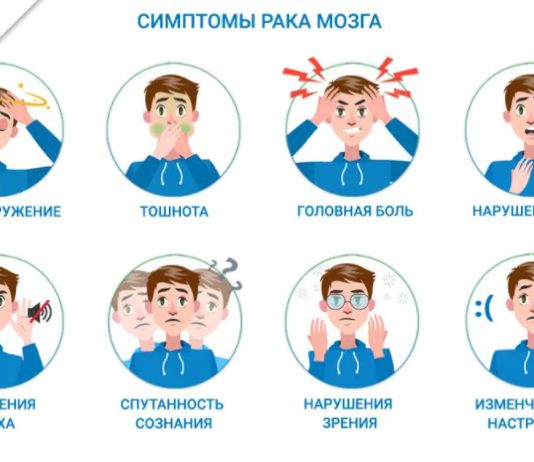Рак головного мозга — симптомы на раннем этапе развития заболевания, мнение онколога-хурирга Рак головного мозга - симптомы на раннем этапе развития заболевания, мнение онколога-хурирга